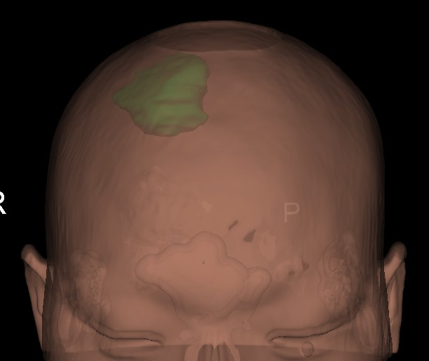 部分手术及科普视频剪辑
