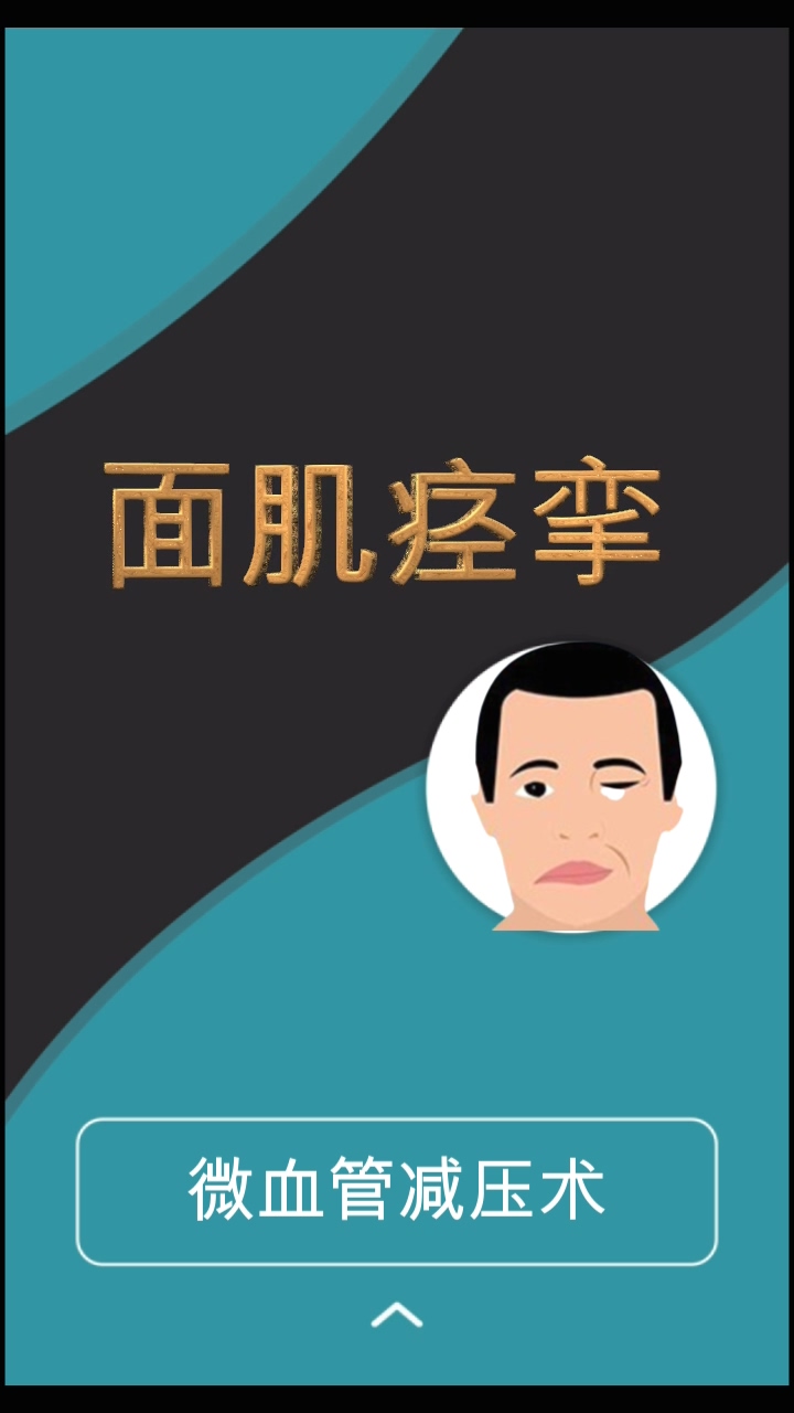 面肌痉挛的血管三维重建及手术治疗