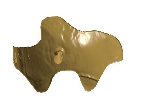 脑出血穿刺导板演示